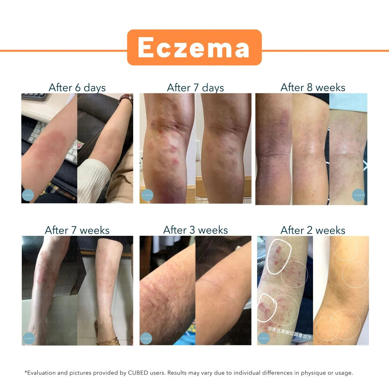 Body Eczema Relief Trio
