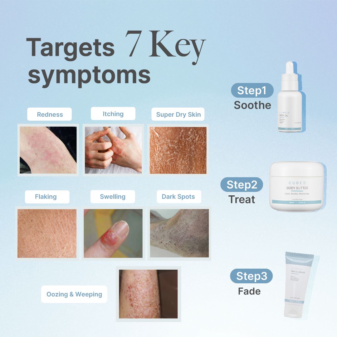Body Eczema Relief Trio